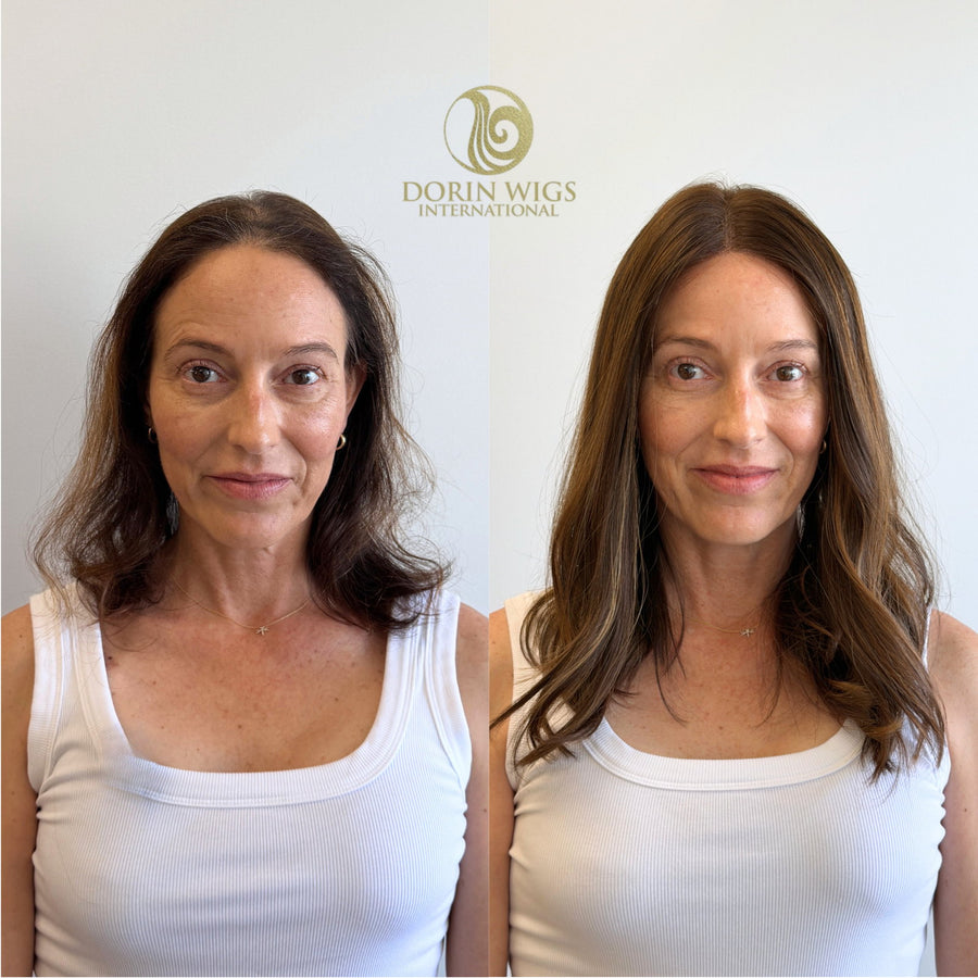 Dorin Wigs client before and after a hair topper fitted for natural volume