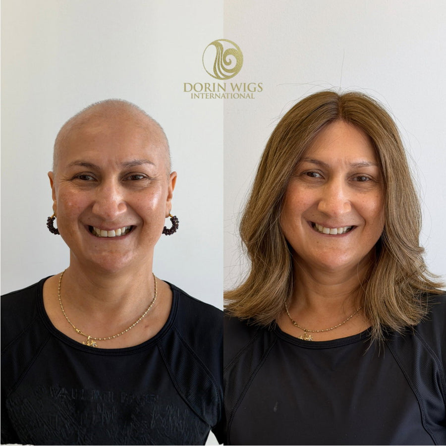 Dorin Wigs client before and after a full-coverage hand-tied wig fitting